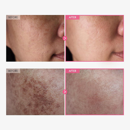 KOREAN Arbutin Brightening™